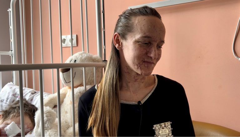 Фото 4 до: Історія мами та її двох синів-близьнюків, яким врятували зір