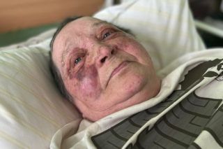 Історія Тетяни Антонюк - журналістки з Херсону, яку побили росіяни