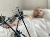 Фото 9 к: История уникальной операции, которую провели львовские врачи