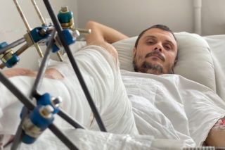 Історія унікальної операції, яку провели львівські лікарі