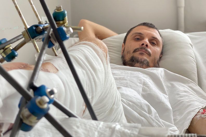 Історія унікальної операції, яку провели львівські лікарі