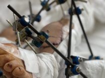 Фото 7 к: История уникальной операции, которую провели львовские врачи