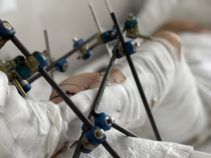 Фото 6 к: История уникальной операции, которую провели львовские врачи