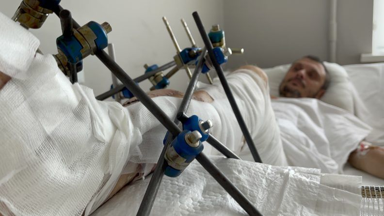 Фото 3 к: История уникальной операции, которую провели львовские врачи