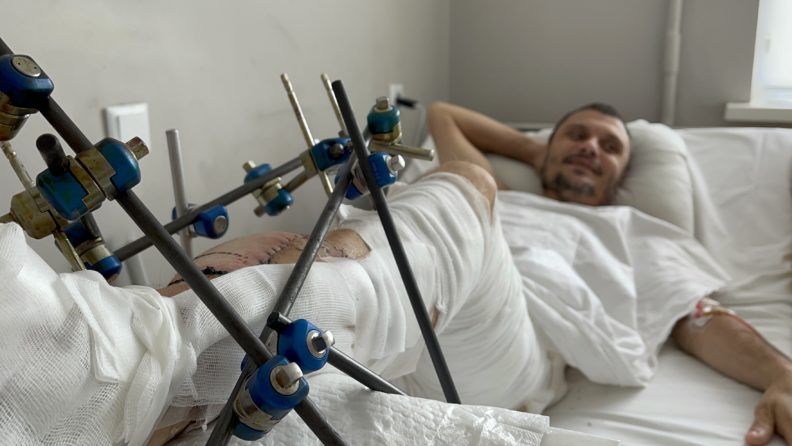 Фото 5 к: История уникальной операции, которую провели львовские врачи