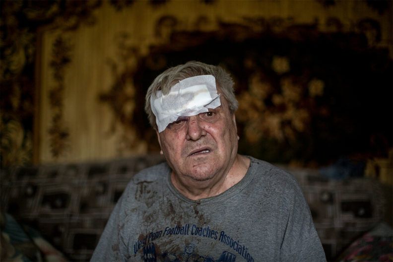 Фото 1 до: Обстріли міста Часів Яр 9 липня: окупанти влучили у багатоповерхівку