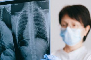 Мамографія