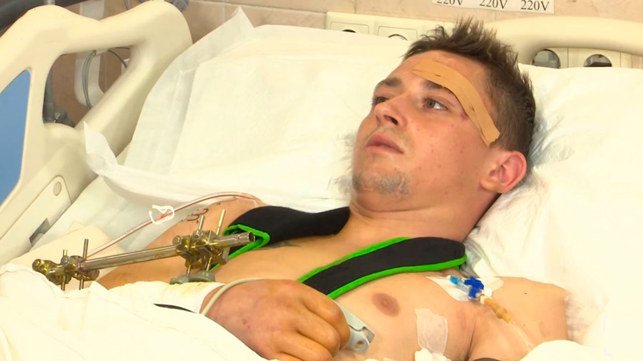 Історія Ярослава, який постраждав від обстрілу села Дніпровське на Нікопольщині