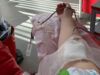Як часто можна здавати кров чоловікам та жінкам: МОЗ про правила донорства