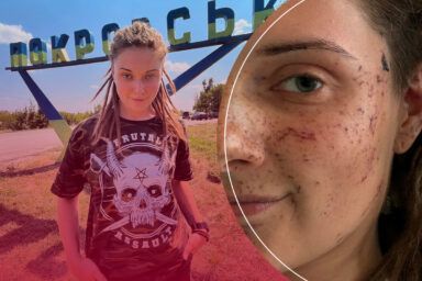 Фото к: История Ады, которая, несмотря на ампутацию, планирует вернуться на фронт