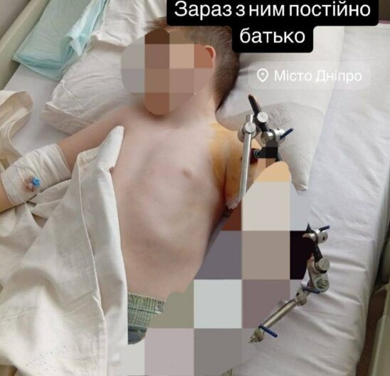 Мама закрыла его собой… Как 8-летний Матвей выжил во время атаки на Кривой Рог