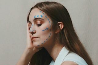 Підтяжка обличчя