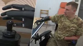 біонічний протез