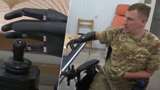біонічний протез