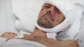 Ламінування вій: усе, що тобі було цікаво дізнатися про ефект, протипоказання та догляд за віями