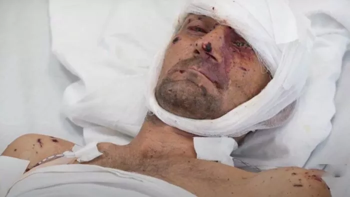 Не хочу, щоб мої діти жили у підвалі — харківські чемпіони створили волонтерські штаби