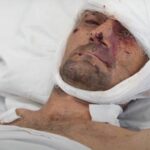 Осколок выбил глаз, но не задел мозг — история спасения Виктора (18+)