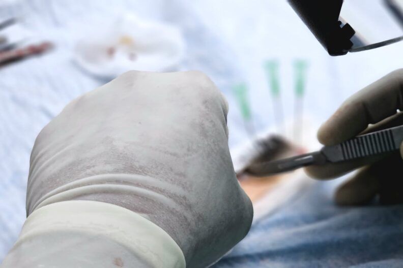 В Киеве женщина умерла во время пластической операции: хирургу вручили подозрение