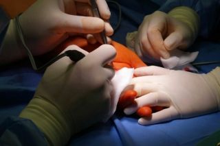 Як 100 лікарів у Барселоні повернули жінці здатність дихати та говорити