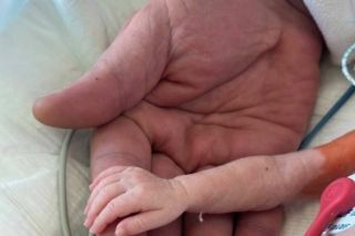 В Інституті серця прооперували крихітне маля