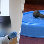 Болт прошел сквозь череп! Как нейрохирурги из Днепра 5 часов спасали раненого бойца