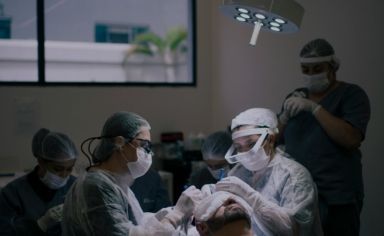 Пересадка волосся у Стамбулі: як це робиться